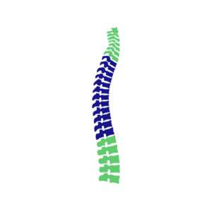 Musculoskeletal: scoliosis